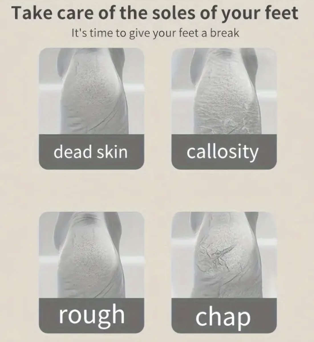 Wireless USB Charging Callus Remover