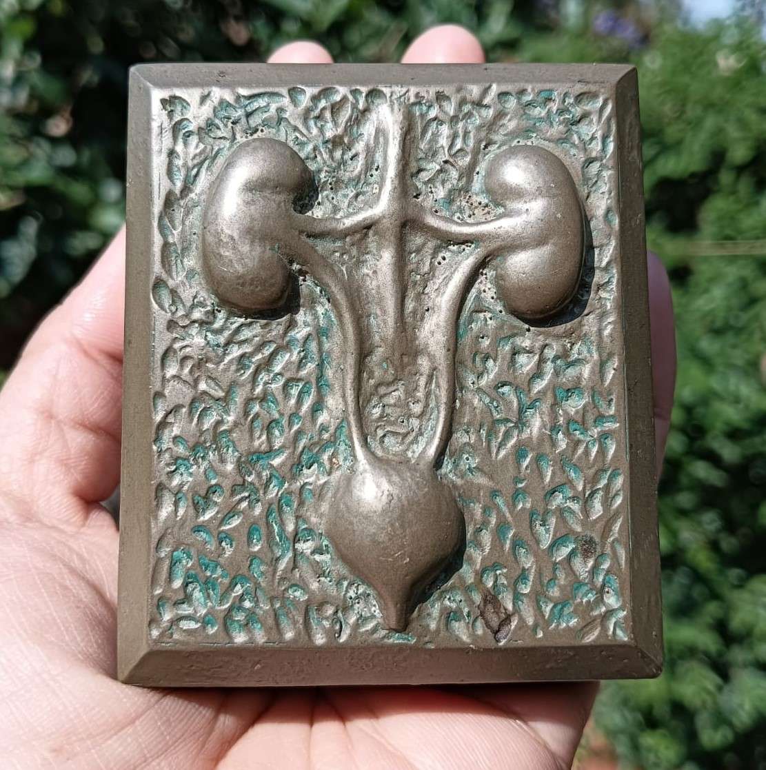 Five Medical Themed Paperweights: Lungs, Kidneys, Stomach, Femur, Hair