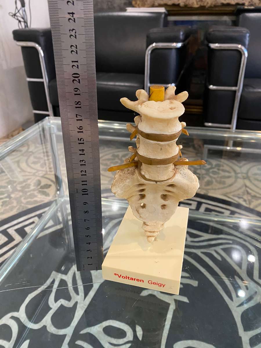 Rare Anatomical Lumbar Spine Model by Voltaren Geigy
