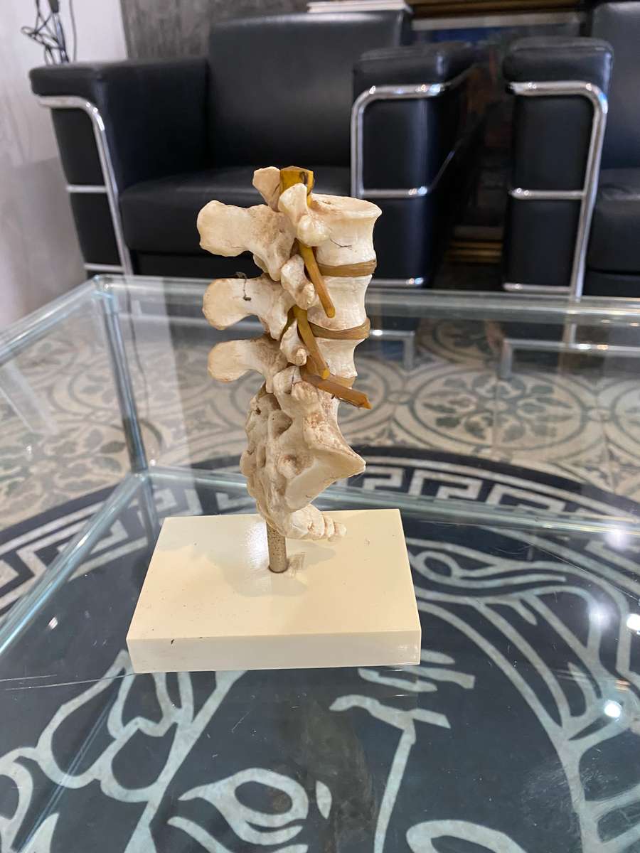 Rare Anatomical Lumbar Spine Model by Voltaren Geigy