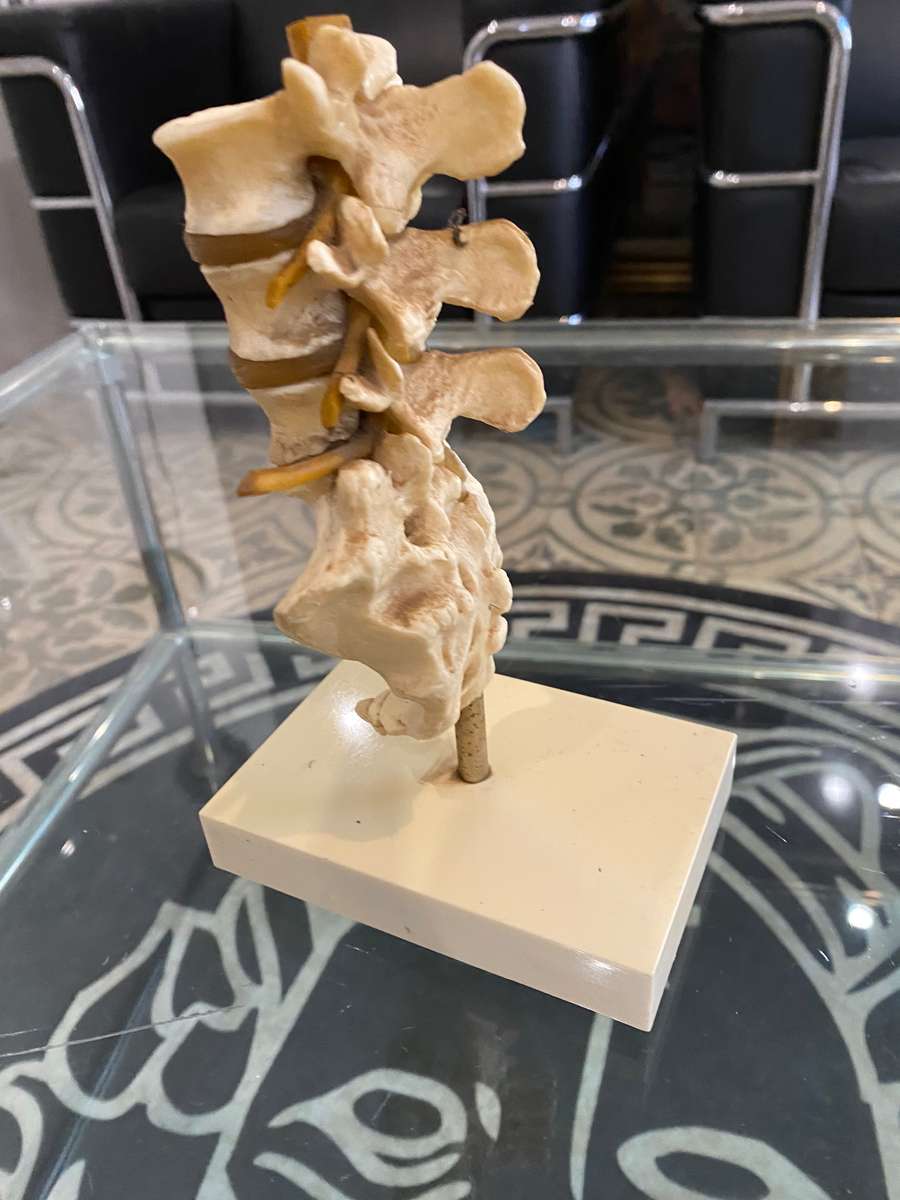 Rare Anatomical Lumbar Spine Model by Voltaren Geigy