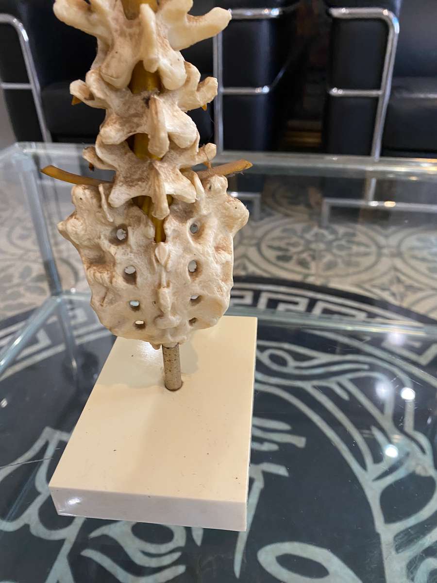 Rare Anatomical Lumbar Spine Model by Voltaren Geigy