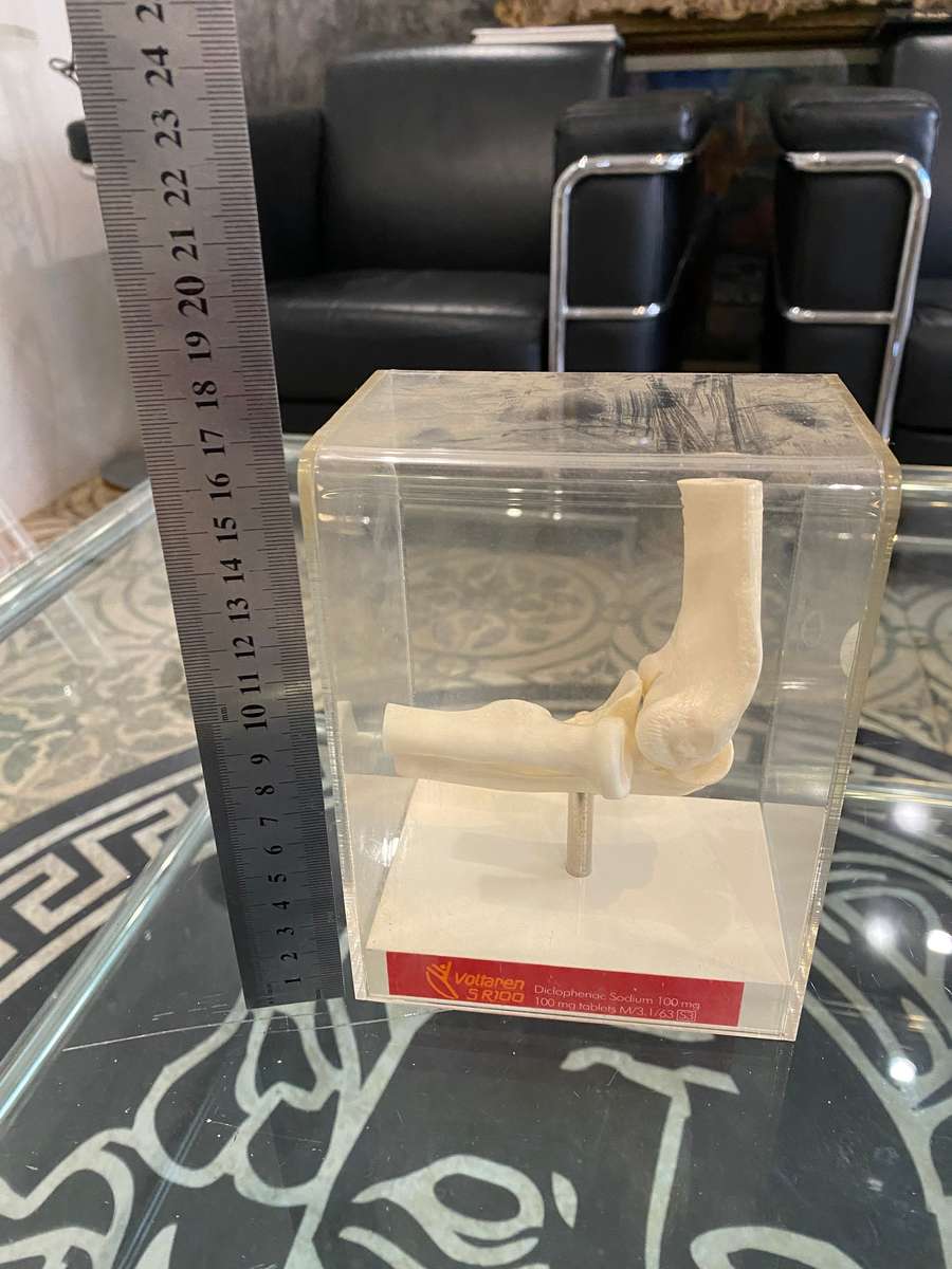 Human Elbow Joint Case