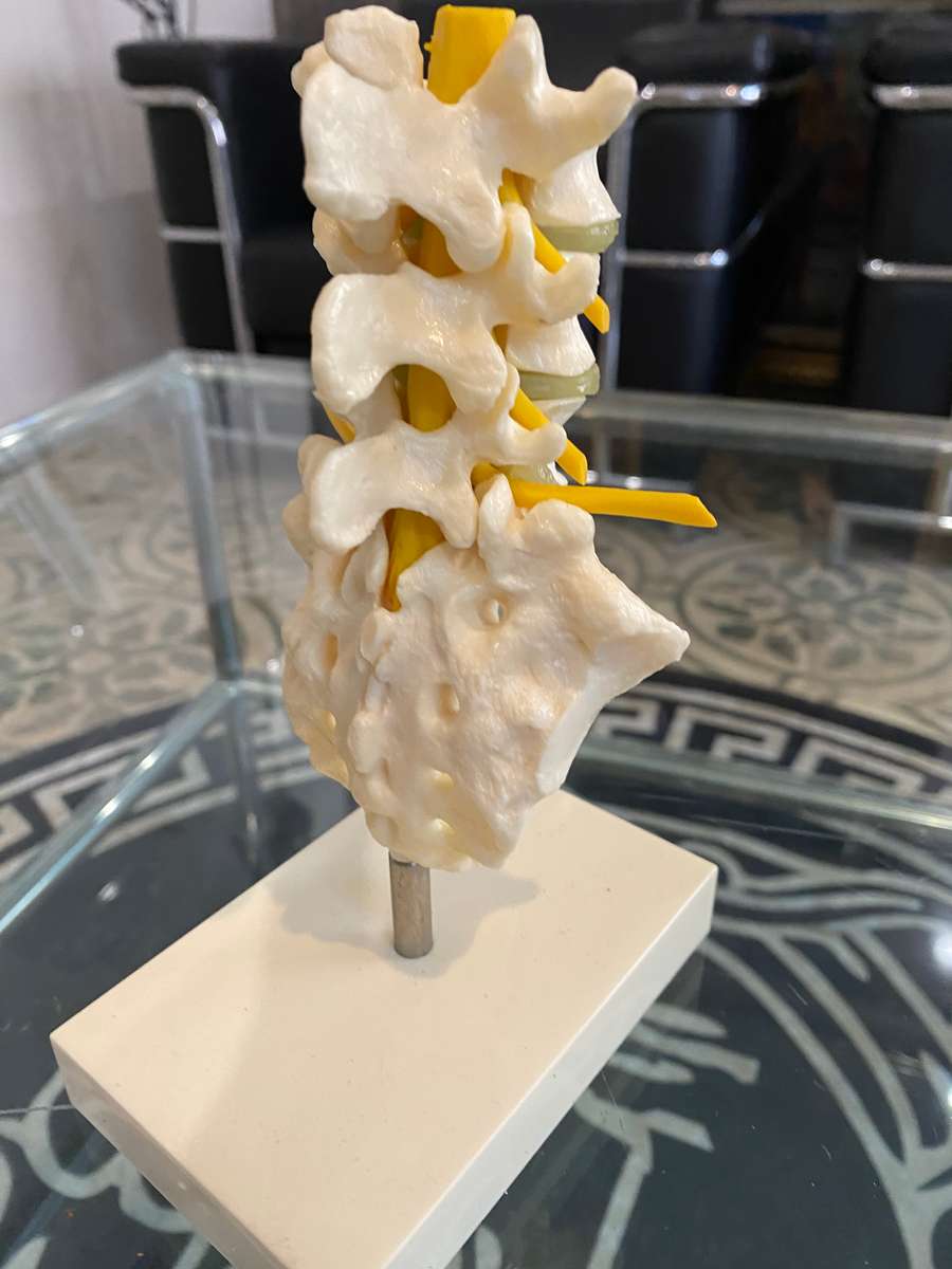 Voltaren Geigy Spine