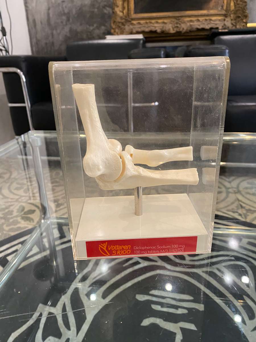 Human Elbow Joint Case