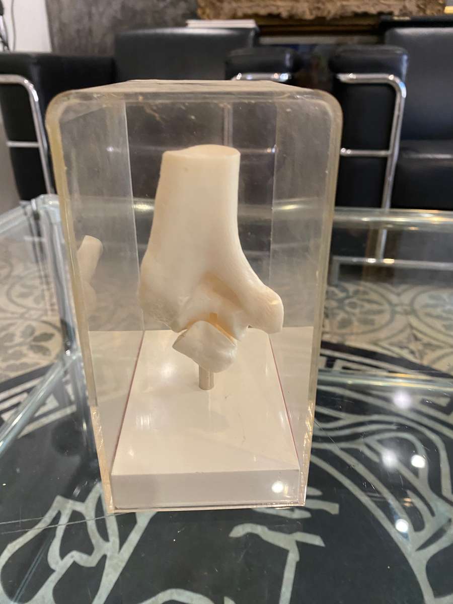 Human Elbow Joint Case