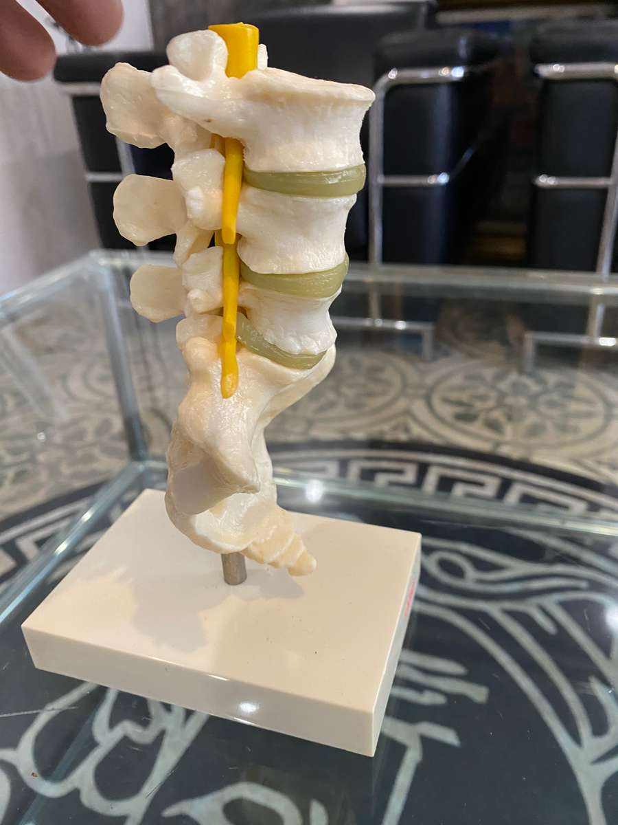 Voltaren Geigy Spine