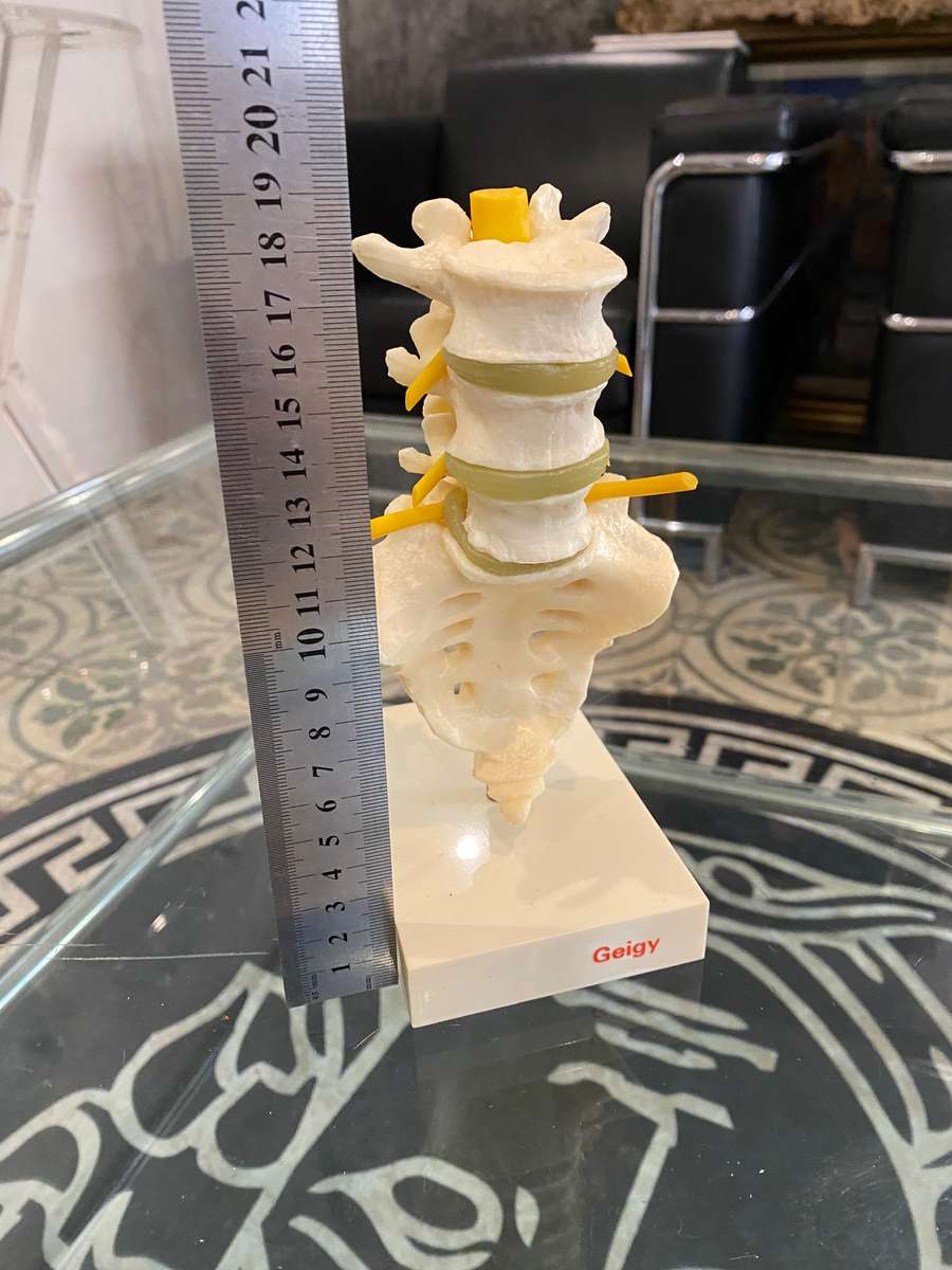 Voltaren Geigy Spine