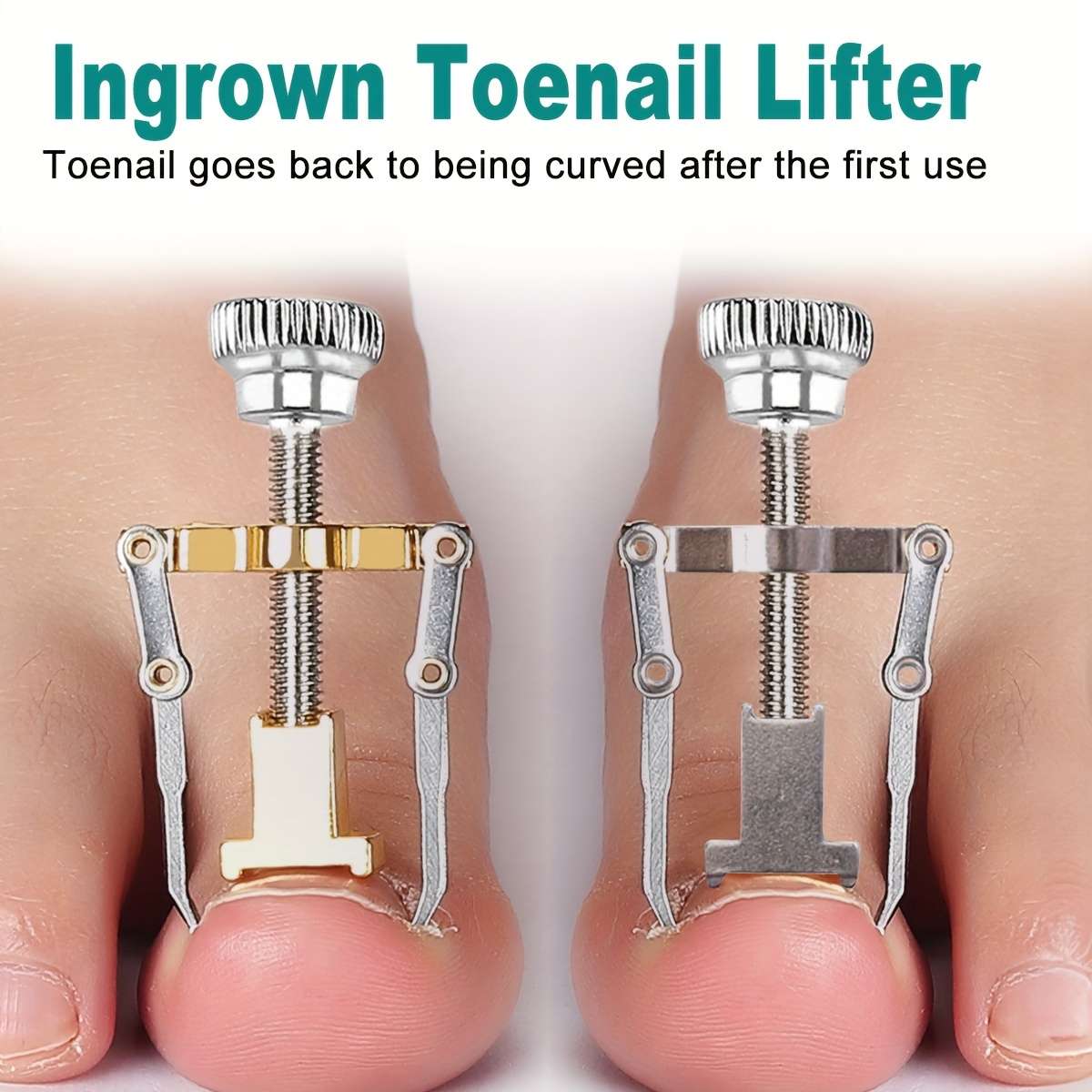 1Pc Professional Ingrown Toenail Correction Tool