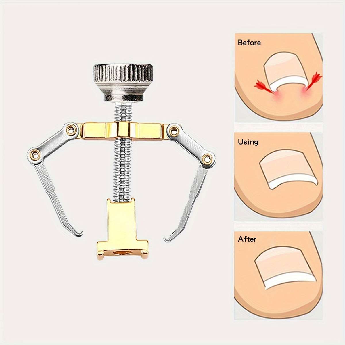 1Pc Professional Ingrown Toenail Correction Tool