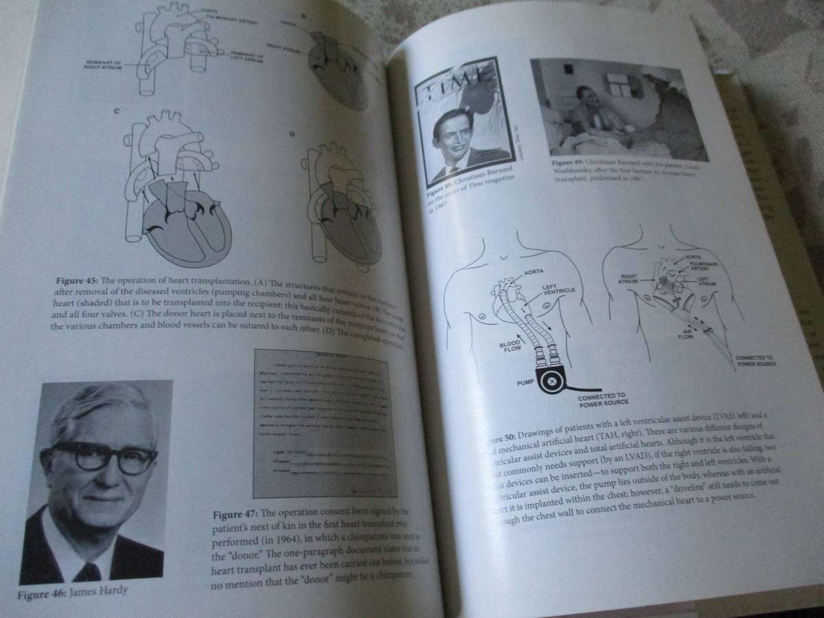 OPEN HEART - THE RADICAL SURGEONS WHO REVOLUTIONIZED MEDICINE - DAVID K.C. COOPER, MD