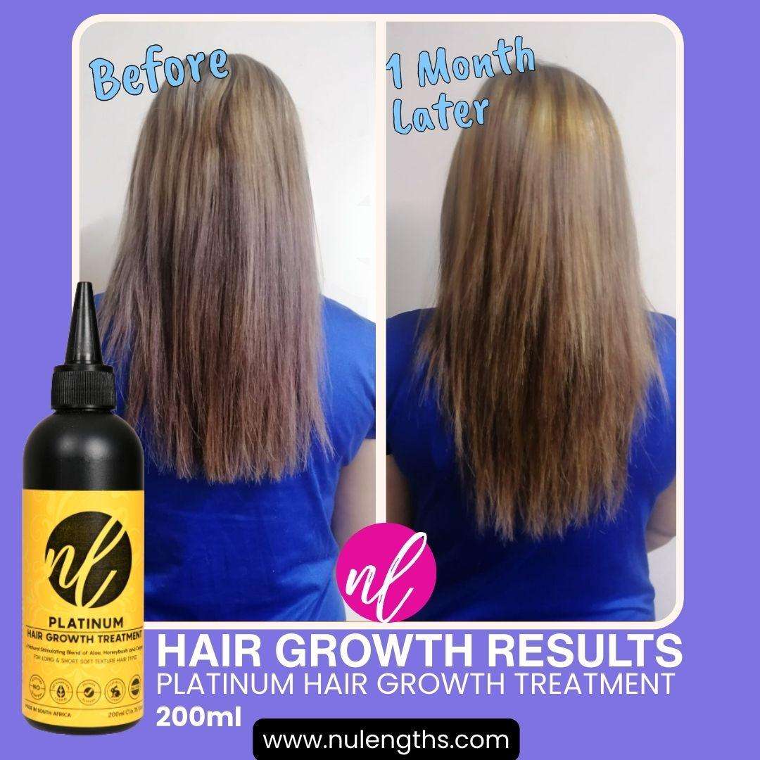 Platinum Hair Growth Treatment 50ml