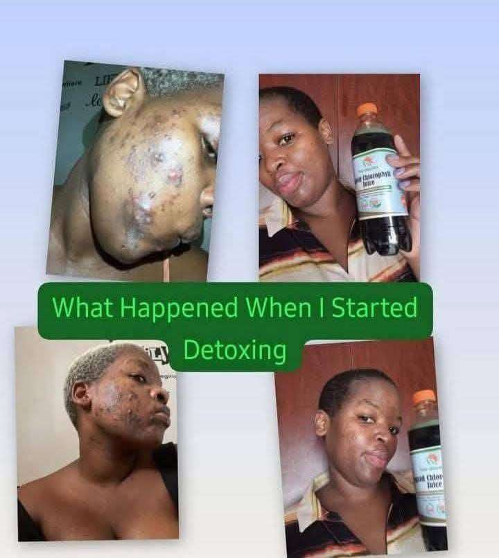 Liquid chlorophyll juice - Natural detox and skin glow supplement