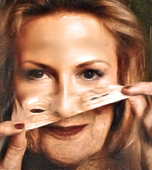 LT Wand Laser Therapy @ Home - ACNE - WRINKLES - CELLULITE - HAIR LOSS - PAIN - SCARS - MUCH MORE...