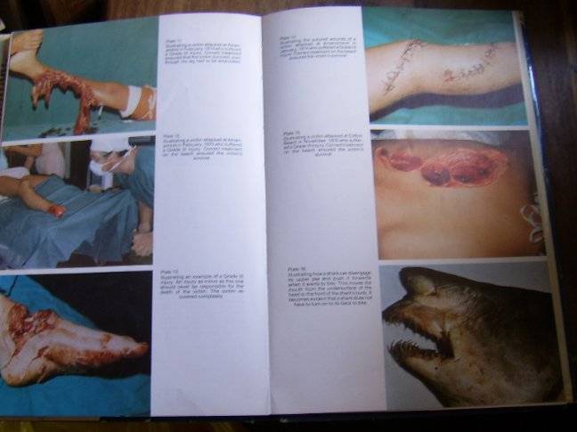 WALLETT, Tim - Shark Attack In Southern African Waters & Treatment of Victims - (H/C in Wrapper)
