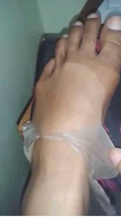 Yellow Peeling oil (Derma Strength) 50ml