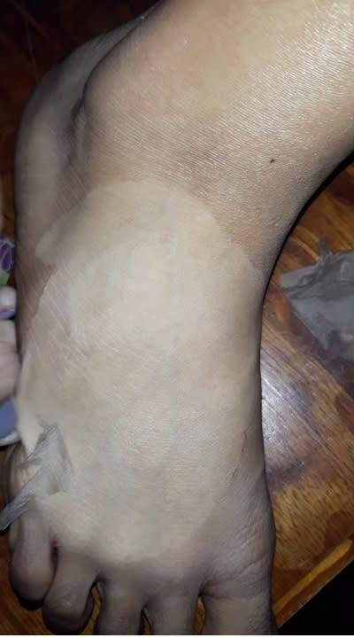 Yellow Peeling oil (Derma Strength) 50ml