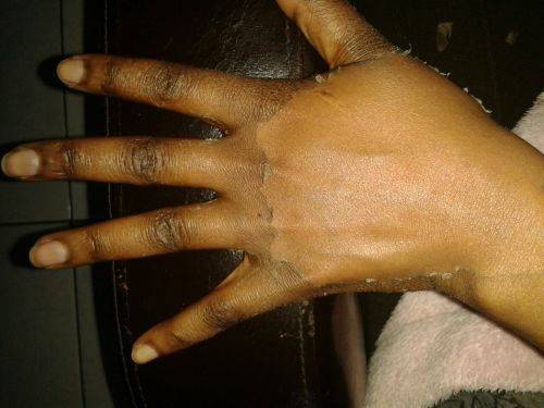 Yellow Peeling oil (Derma Strength) 50ml