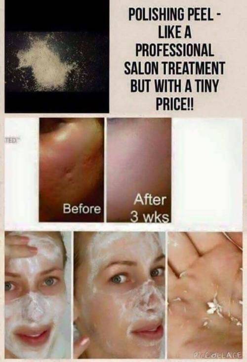 POLISHING PEEL SKIN REFINISHER