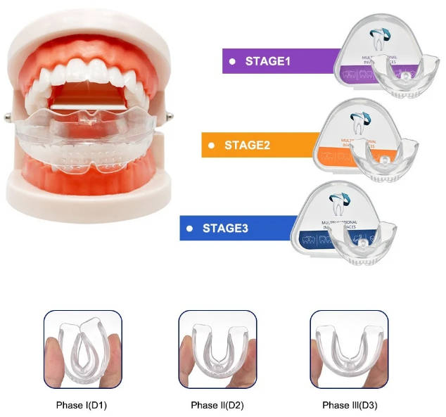 Teeth Aligner - Complete 3 stage Set - Adult - invisible