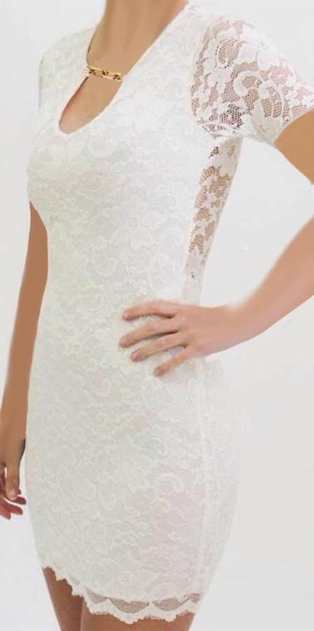 Beautiful scalloped lace dress with gold chain detail. HURRY WHILE STOCKS LAST AT THIS PRICE