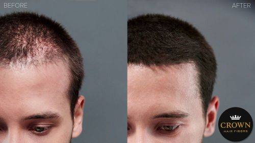 Crown Hair Fibers 25g Conceal Hair Loss - Black