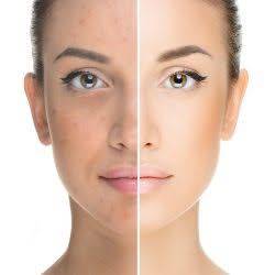 Kojic Acid Powder 99