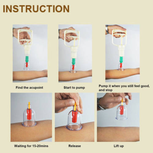 24 Cups Biomagnetic Vacuum Body Cupping Therapy Set Unboxed