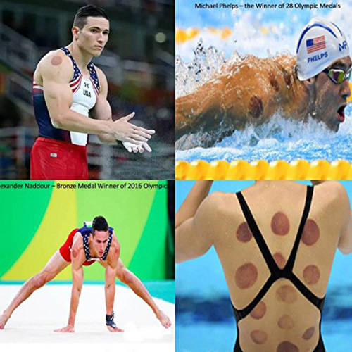 24 Cups Biomagnetic Vacuum Body Cupping Therapy Set Unboxed