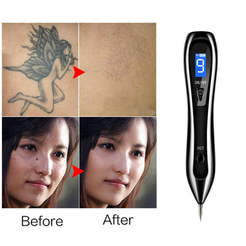 9 level LCD Face Skin Dark Spot Remover Mole Tattoo Laser Pen-Black
