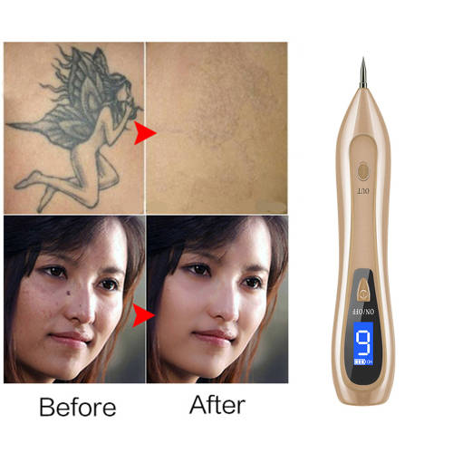 9 level LCD Face Skin Dark Spot Remover Mole Tattoo Laser Pen
