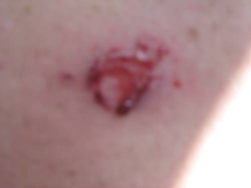 TIPX MEGA PROTECTION PACK