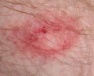 TIPX MEGA PROTECTION PACK