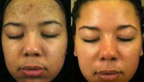 Organo Essentials Premium with Glutathion, Cleansing Soap Bar