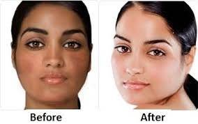 #1 Skin Whitening Glutathione SPF50++ cosmetic soap 70g.Pure Gluta,Vit B3+E+C,rice milk.NO lye.
