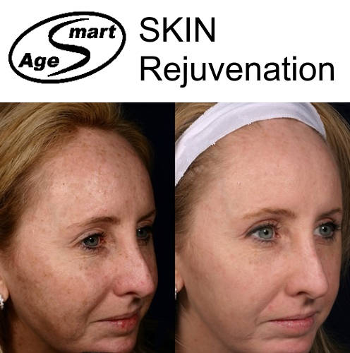 7 days skin whitening essence.100 g. Natural 100% Organic cleanser Hypoallergenic Anti-acne