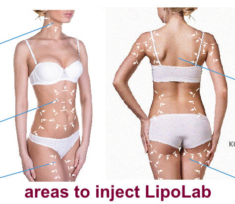 #1 Insane  Special PPC LipoLab Slim1vial=20injection Weight loss.skin tightening and lifting