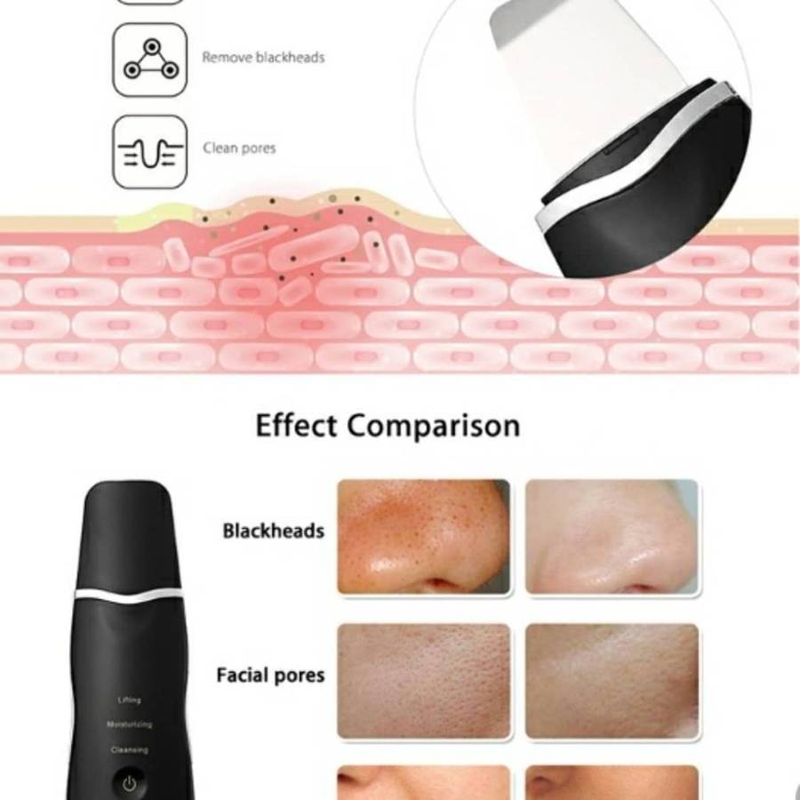 Blackhead remover