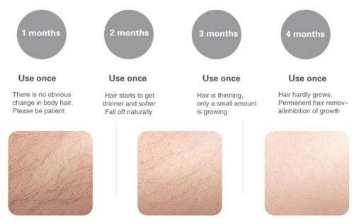 2019 Professional Permanent IPL Epilator - 600,000 flashes