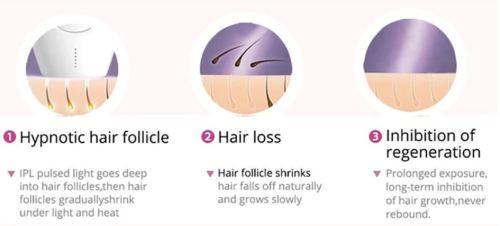 2019 Professional Permanent IPL Epilator - 600,000 flashes