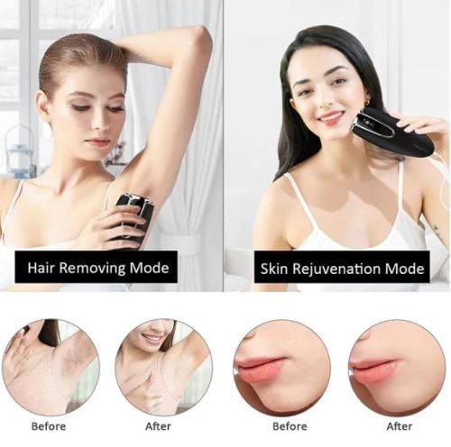 Permanent Painless Shaver Portable Epilator Laser Hair Removal Machine for Home use