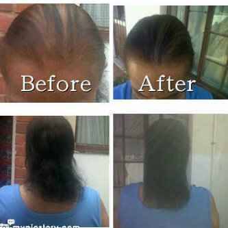PEANIE HAIR GROWTH TONIC - shipping only R30-00 extra Get yours now!!!!