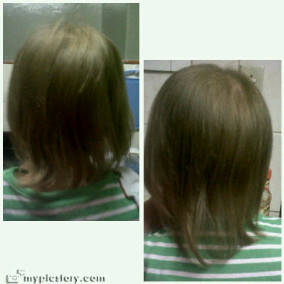 PEANIE HAIR GROWTH TONIC - SAFE FOR TODDLERS - KIDS ALL AGES shipping R30-00 Get yours now!!!!