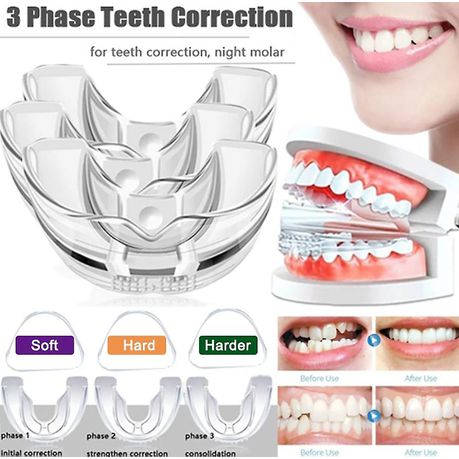 Teeth Grinding - 3 Stage Bruxism TMJ Plate