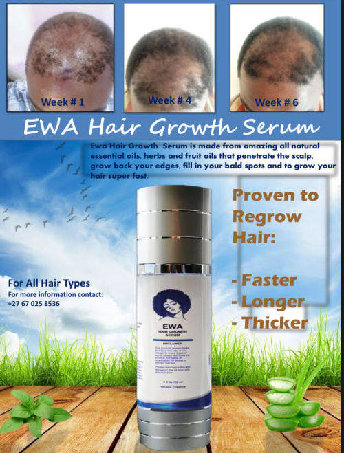 Grow your hair and stop hair loss Today