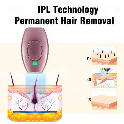 ILP Hair Removal Handset