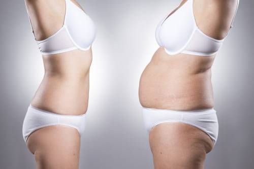 Laser Lipo x 4 Sessions at Brazen Beauty Bar - Randburg, Johannesburg
