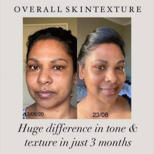 *AUTHENTIC* ageLOC LumiSpa Beauty Device Face Cleansing Kit + Activating Cleanser of Your Choice