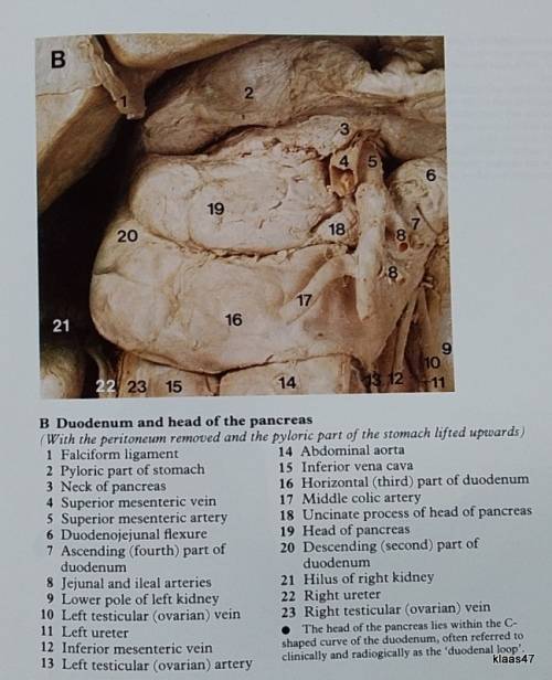 A Colour Atlas of Human Anatomy - R.M.H. Mc Minn and R.T. Hutchings - Hardcover