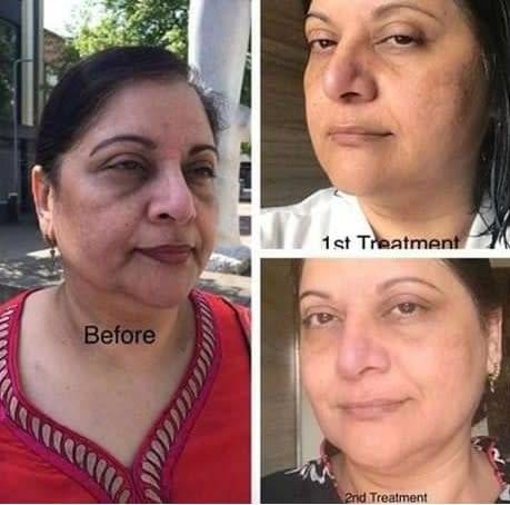 Nu Skin AHA Facial Peel and Neutraliser